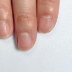どの指がお悩み爪さんかわかりますか？